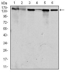 Figure 2: Western blot analysis using MSH6 mouse mAb against HEK293 (1), HCT116 (2), A549 (3), A431 (4), MCF-7 (5) and HepG2 (6) cell lysate.