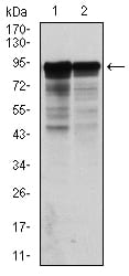 Figure 2: Western blot analysis using NEFL mouse mAb against Hela (1) and Jurkat (2) cell lysate.