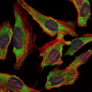 Figure 4: Immunofluorescence analysis of Hela cells using NEFL mouse mAb (green). Blue: DRAQ5 fluorescent DNA dye. Red: Actin filaments have been labeled with Alexa Fluor-555 phalloidin.