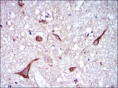 Figure 3: Immunohistochemical analysis of paraffin-embedded brain tissues using NEFL mouse mAb with DAB staining.