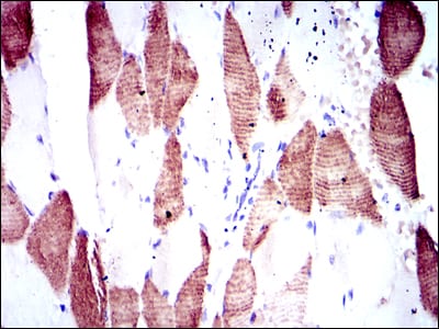 Figure 3: Immunohistochemical analysis of paraffin-embedded muscle tissues using RPS6KB1 mouse mAb with DAB staining.