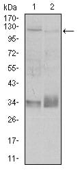 Figure 2: Western blot analysis using ITGB1 mouse mAb against A549 (1), and Jurkat (2) cell lysate.