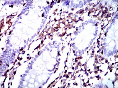 Figure 3: Immunohistochemical analysis of paraffin-embedded colon tissues using MSN mouse mAb with DAB staining.