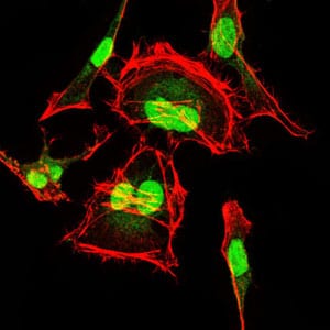 Figure 5: Immunofluorescence analysis of HeLa cells using CDK2 mouse mAb (green). Red: Actin filaments have been labeled with Alexa Fluor-555 phalloidin.
