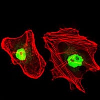 Figure 5: Immunofluorescence analysis of HeLa cells using RPA1 mouse mAb (green). Red: Actin filaments have been labeled with Alexa Fluor-555 phalloidin.