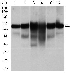 Figure 2: Western blot analysis using CK5 mouse mAb against A431 (1), MCF-7 (2), HeLa (3), HepG2 (4), 3T3-L1 (5), and COS-7 (6) cell lysate.