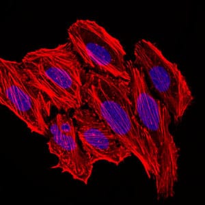 Figure 4: Immunofluorescence analysis of HepG2 cells. Blue: DRAQ5 fluorescent DNA dye. Red: Actin filaments have been labeled with Alexa Fluor-555 phalloidin.