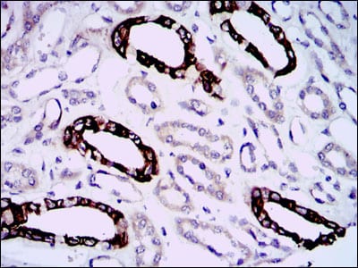 Figure 4: Immunohistochemical analysis of paraffin-embedded kidney tissues using GAB1 mouse mAb with DAB staining.