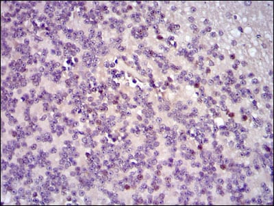 Figure 4: Immunohistochemical analysis of paraffin-embedded cerebellum tissues using FOS mouse mAb with DAB staining.
