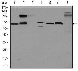 Figure 2: Western blot analysis using GPC3 mouse mAb against HepG2 (1), HEK293 (2), Jurkat (3), SK-N-SH (4), PC-12 (5), F9 (6)and Mouse liver (7) cell lysate.