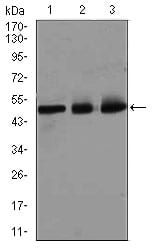 Figure 2: Western blot analysis using E2F1 mouse mAb against HeLa (1), SK-N-SH (2), and NIH3T3 (3) cell lysate.