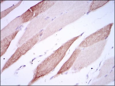 Figure 3: Immunohistochemical analysis of paraffin-embedded striated muscle tissues using AlCAM mouse mAb with DAB staining.