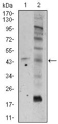 Figure 2: Western blot analysis using FZD5 mouse mAb against A549 (1), and PC-3 (2) cell lysate.