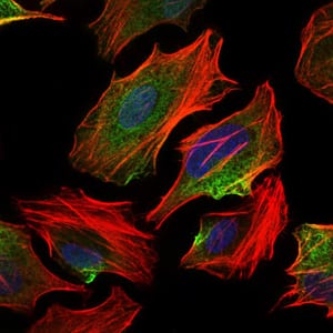 Figure 3: Immunofluorescence analysis of HeLa cells using ACLY mouse mAb (green). Blue: DRAQ5 fluorescent DNA dye. Red: Actin filaments have been labeled with Alexa Fluor-555 phalloidin.