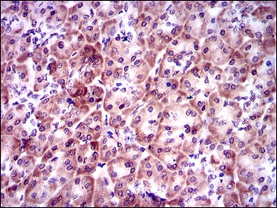 Figure 5: mmunohistochemical analysis of paraffin-embedded pancreas tissues using PSAP mouse mAb with DAB staining.