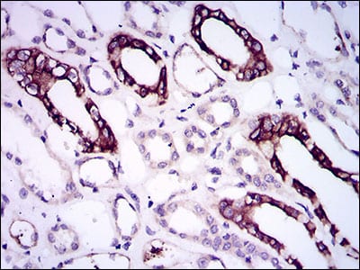 Figure 5: Immunohistochemical analysis of paraffin-embedded kidney tissues using BMPR1A mouse mAb with DAB staining.