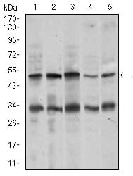 Figure 2: Western blot analysis using CHGA mouse mAb against MOLT4 (1), SK-N-SH (2), HepG2 (3), PC-12 (4), and C6 (5) cell lysate.