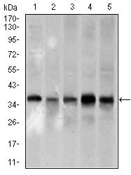 Figure 3: Western blot analysis using PCNA mouse mAb against A431 (1), HeLa (2), HepG2 (3), Raji (4), and MOLT4 (5) cell lysate.