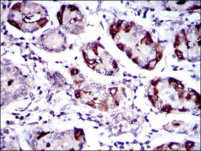 Figure 6: Immunohistochemical analysis of paraffin-embedded stomach tissues using SLC27A5 mouse mAb with DAB staining.