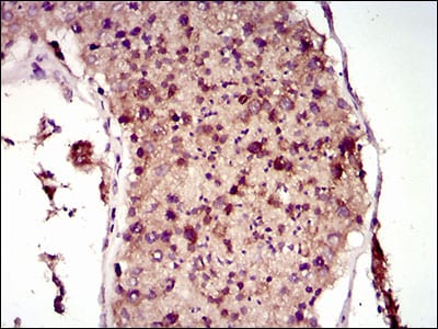 Figure 5: Immunohistochemical analysis of paraffin-embedded testis tissues using MAP1LC3A mouse mAb with DAB staining.