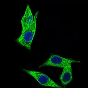 Figure 3: Immunofluorescence analysis of HepG2 cells using C17ORF53 mouse mAb (green). Blue: DRAQ5 fluorescent DNA dye.