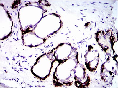 Figure 4: Immunohistochemical analysis of paraffin-embedded prostate tissues using CK5 mouse mAb with DAB staining.