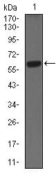 Figure 2: Western blot analysis using CK5 mouse mAb against A431 (1) cell lysate.