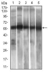 Figure 3: Western blot analysis using ALDH2 mouse mAb against HepG2 (1), A549 (2) cell lysate? and Rat liver (3), Mouse liver (4), Mouse brain (5) tissue lysate.