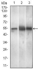 Figure 3: Western blot analysis using PAX3 mouse mAb against Mouse brain (1), Rat spleen (2), Mouse liver (3) cell lysate.