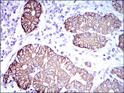 Figure 5: Immunohistochemical analysis of paraffin-embedded stomach tissues using CK5 mouse mAb with DAB staining.