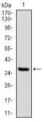 Figure 1: Western blot analysis using NPC1 mAb against human NPC1 recombinant protein. (Expected MW is 37.6 kDa)