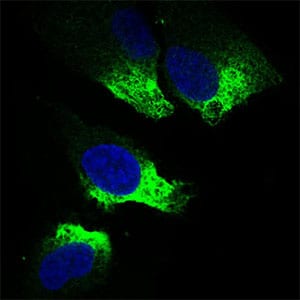 Figure 4: Immunofluorescence analysis of Hela cells using TWIST1 mouse mAb (green). Blue: DRAQ5 fluorescent DNA dye.