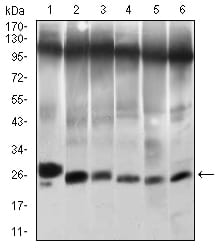 Figure 3: Western blot analysis using TWIST1 mouse mAb against NIH/3T3 (1), JURKAT (2), HELA (3), A549 (4), RAJI (5) and OCM-1 (6) cell lysate.