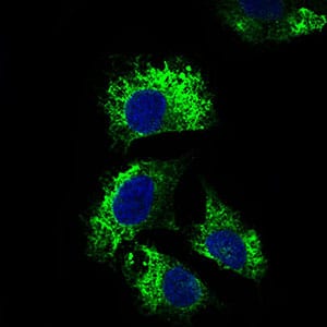 Figure 3: Immunofluorescence analysis of Hela cells using IL2RA mouse mAb (green). Blue: DRAQ5 fluorescent DNA dye.