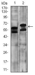 Figure 3: Western blot analysis using CA9 mouse mAb against A431 (1) and SW620 (2) cell lysate.