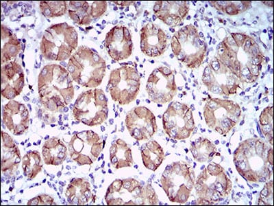 Figure 6: Immunohistochemical analysis of paraffin-embedded stomach tissues using CA9 mouse mAb with DAB staining.