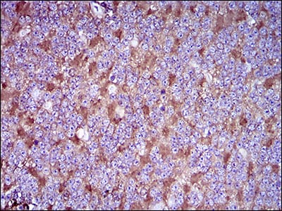 Figure 6: Immunohistochemical analysis of paraffin-embedded cerebellum tissues using THY1 mouse mAb with DAB staining.