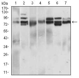 Figure 3: Western blot analysis using CD22 mouse mAb against L1210 (1), Hela (2), HEK293 (3), Jurkat (4), OCM-1 (5), A432 (6) and NIH/3T3 (7) cell lysate.