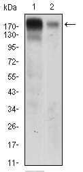 Figure 3: Western blot analysis using EGFR mouse mAb against A431 (1) AND Hela (2) cell lysate.