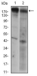 Figure 3: Western blot analysis using EGFR mouse mAb against A431 (1) AND Hela (2) cell lysate.