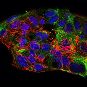 Figure 3: Immunofluorescence analysis of HepG2 cells using SYCP3 mouse mAb (green). Blue: DRAQ5 fluorescent DNA dye. Red: Actin filaments have been labeled with Alexa Fluor-555 phalloidin.