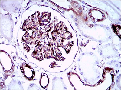 Figure 6: Immunohistochemical analysis of paraffin-embedded kidney tissues using SYCP3 mouse mAb with DAB staining.