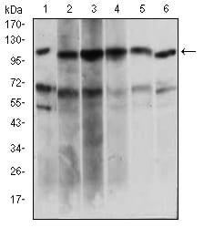 Figure 3: Western blot analysis using PAPLN mouse mAb against Hela (1), HepG2 (2), OCM-1 (3), Raji (4), Jurkat (5), NIH/3T3 (6) cell lysate.