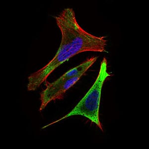 Figure 3: Immunofluorescence analysis of Hela cells using Ring1 mouse mAb (green). Blue: DRAQ5 fluorescent DNA dye. Red: Actin filaments have been labeled with Alexa Fluor-555 phalloidin.