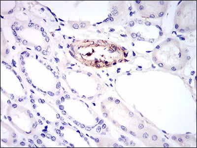 Figure 5: Immunohistochemical analysis of paraffin-embedded kidney tissues using MCAM mouse mAb with DAB staining.