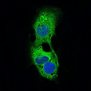 Figure 4: Immunofluorescence analysis of HepG2 cells using PLIN2 mouse mAb (green). Blue: DRAQ5 fluorescent DNA dye. Secondary antibody from Fisher (Cat#: 35503)