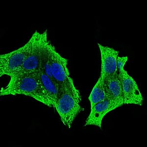 Figure 3: Immunofluorescence analysis of HepG2 cells using CSF1R mouse mAb (green). Blue: DRAQ5 fluorescent DNA dye. Secondary antibody from Fisher (Cat#: 35503)