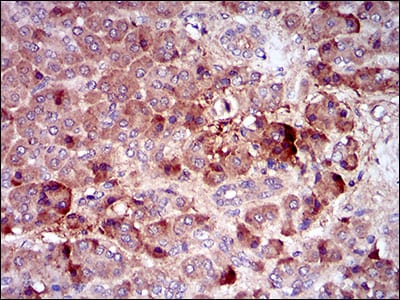 Figure 4: Immunohistochemical analysis of paraffin-embedded pancreas tissues using CSF1R mouse mAb with DAB staining.