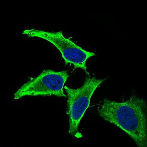 Figure 3: Immunofluorescence analysis of Hela cells using MEF2A mouse mAb (green). Blue: DRAQ5 fluorescent DNA dye. Secondary antibody from Fisher (Cat#: 35503)