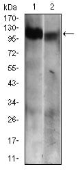 Figure 2: Western blot analysis using RB1 mouse mAb against Jurkat (1) and A431 (2) cell lysate.